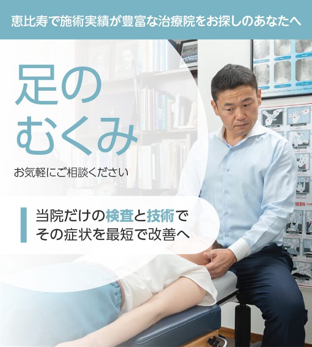 足のむくみもお気軽にご相談ください